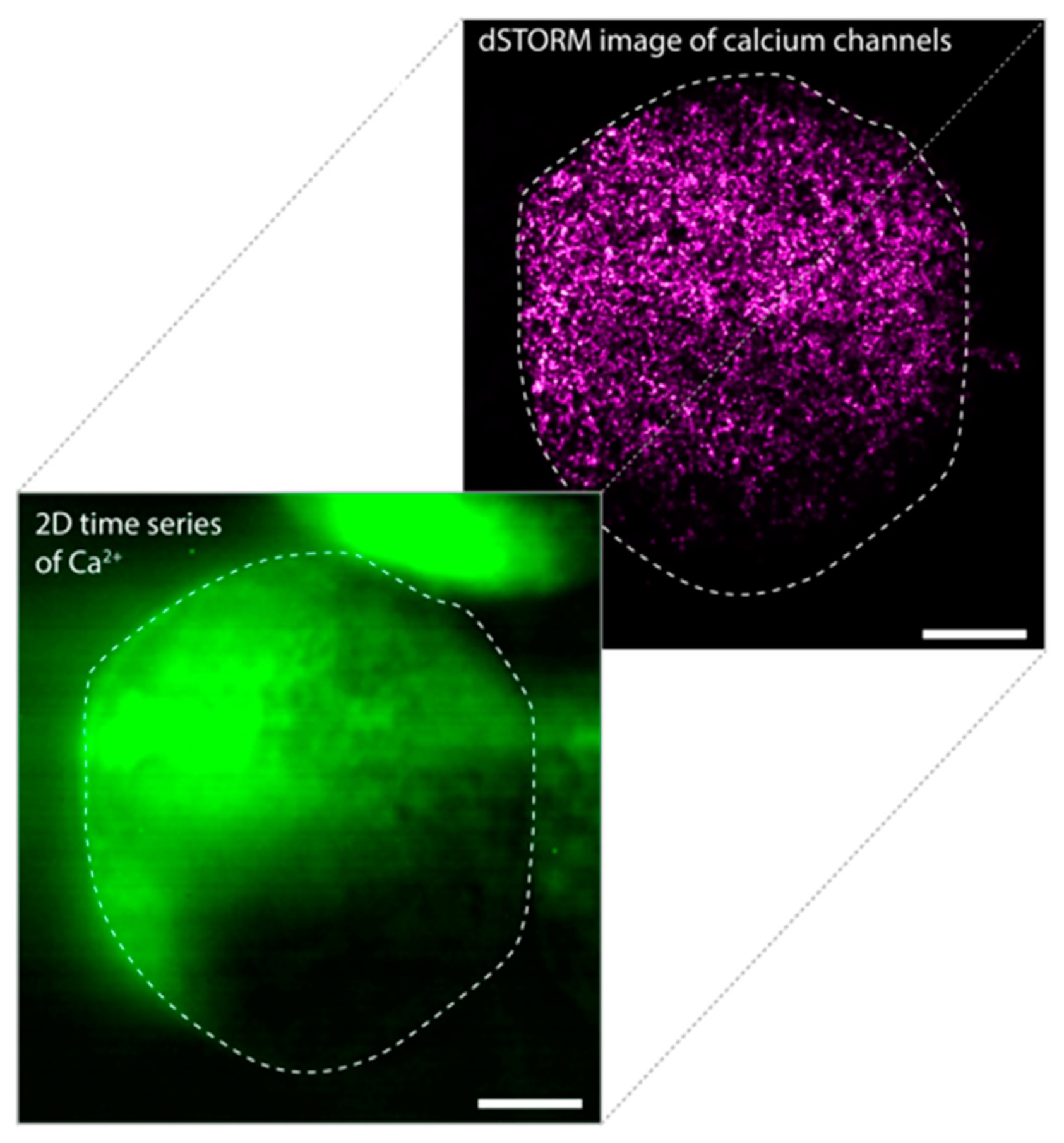 Super-Resolution Analysis of the Origins of the Elementary Events of ER Calcium Release in Dorsal Root Ganglion Neurons