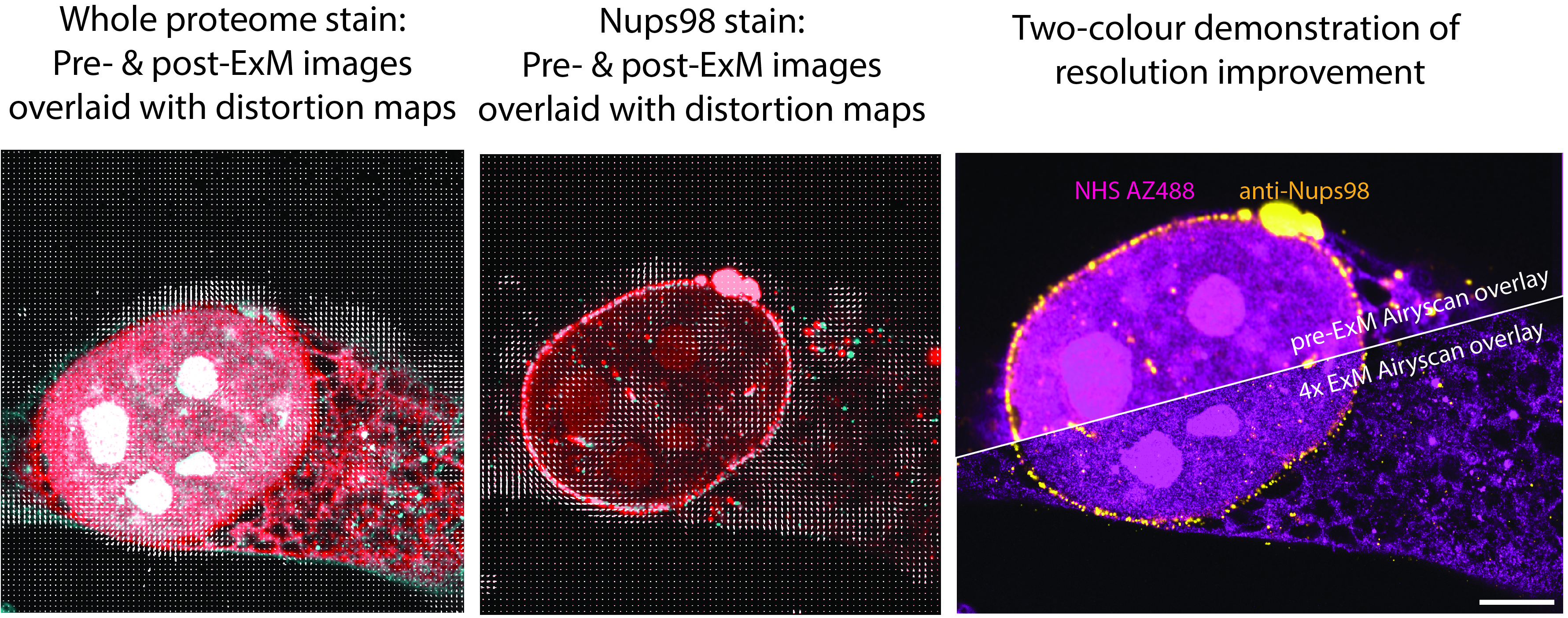 Pre- and post-ExM imaging unlocked the ability to check the distortions in specific cellular regions independently, and display the effective resolution improvement directly.